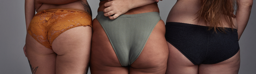 The Truth About Stretch Marks: Myths and Facts Unveiled
